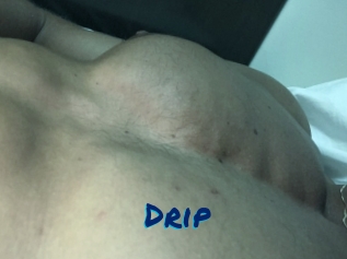 Drip