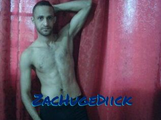ZacHugeDiick